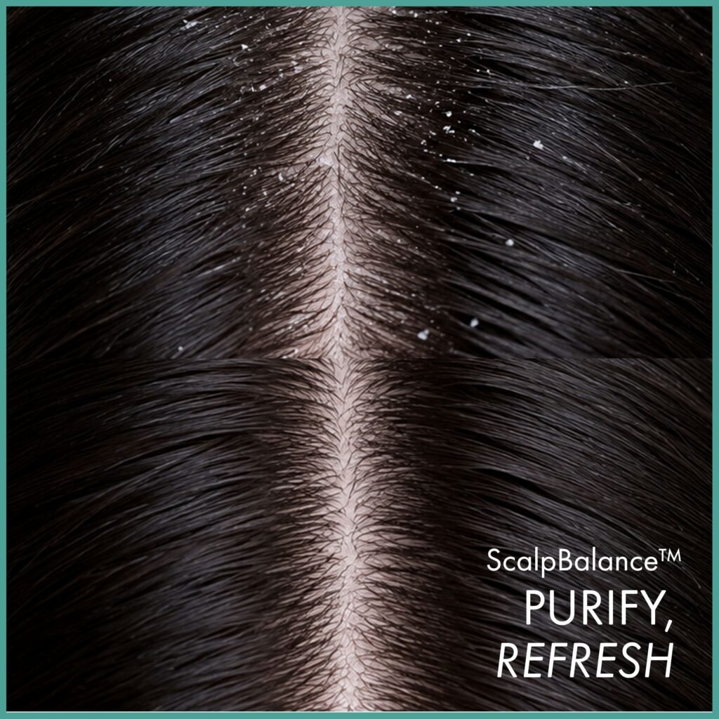 ScalpBalance™ Anti-Dandruff Purifying Shampoo